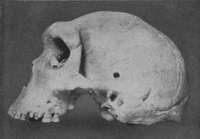 male Skull