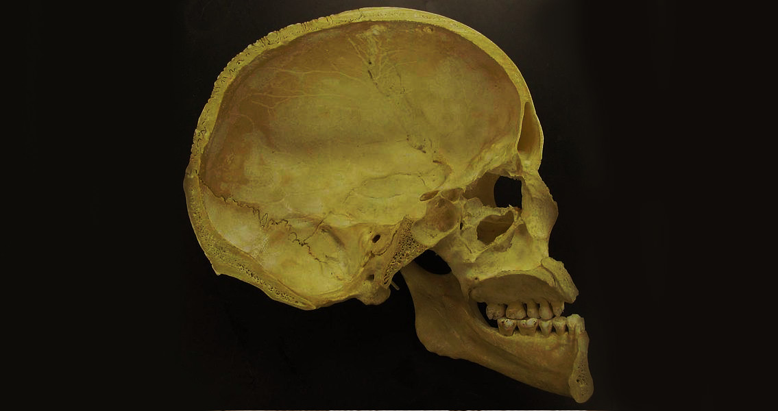 Section-of-Human-Skull