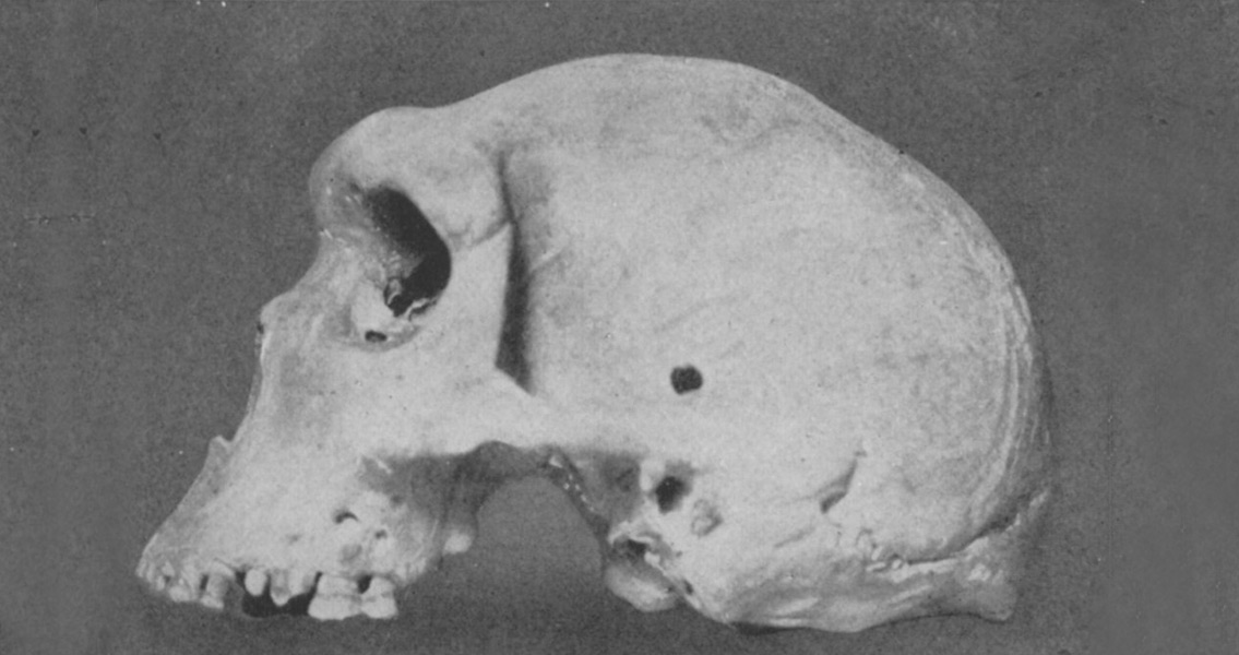 Neanderthal skull