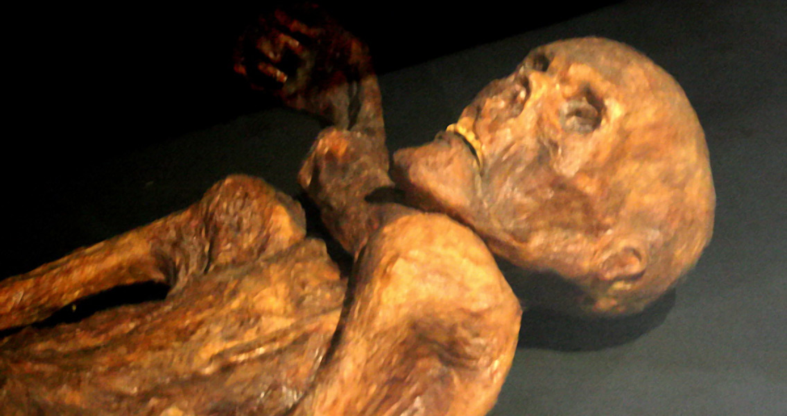 Reconstruction of the Otzi Mummy