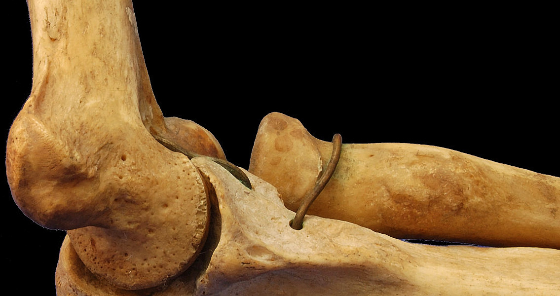 Human Hemerus Bone