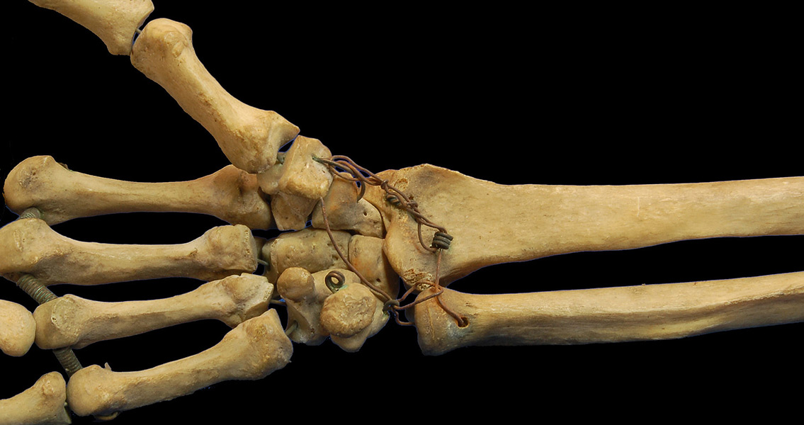 Human Hand Bones