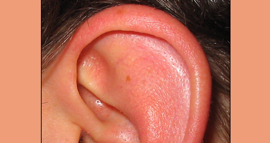 Left Human Ear (2)