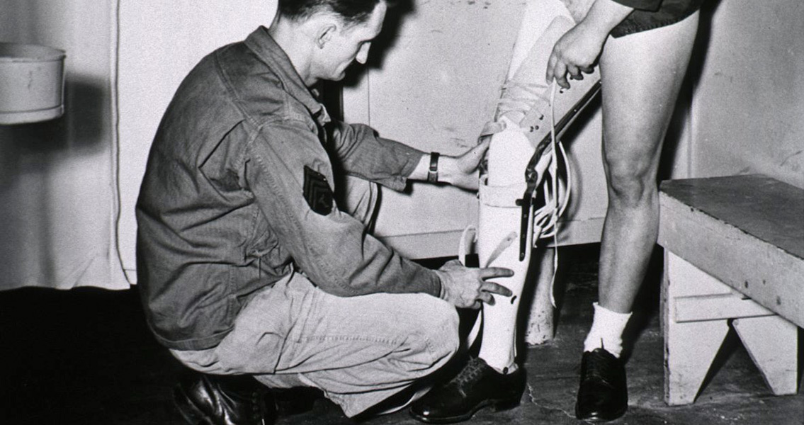 Prosthetic being fitted to a young man