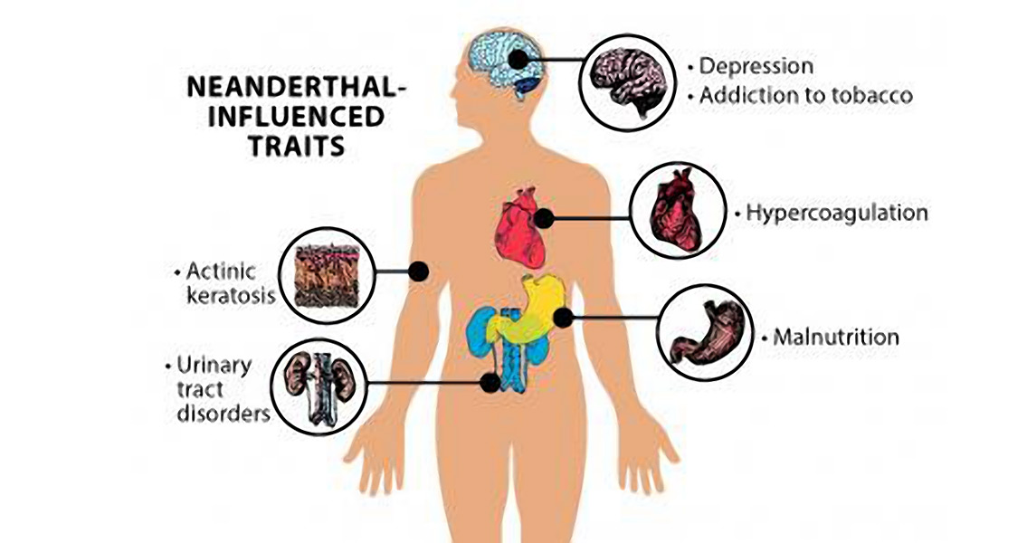 Neanderthal DNA Linked to Depression, Strokes and Smoking