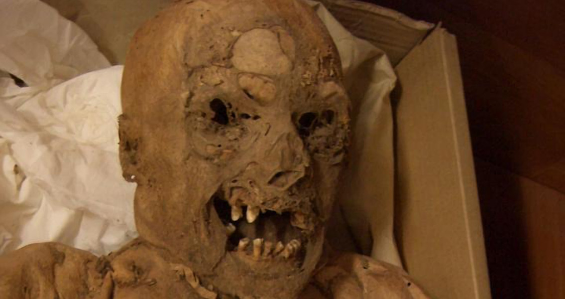 18th-Century Hungarian Mummy May Have Had Cancer Gene