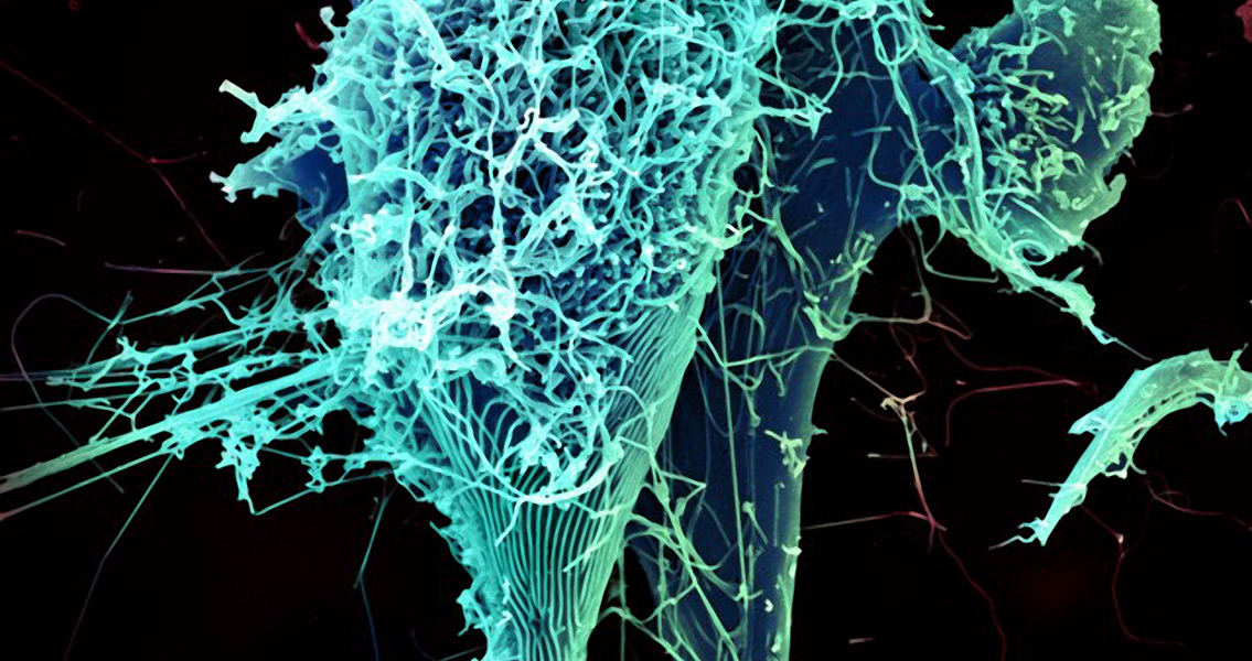 Ebola Virus Particles (3)