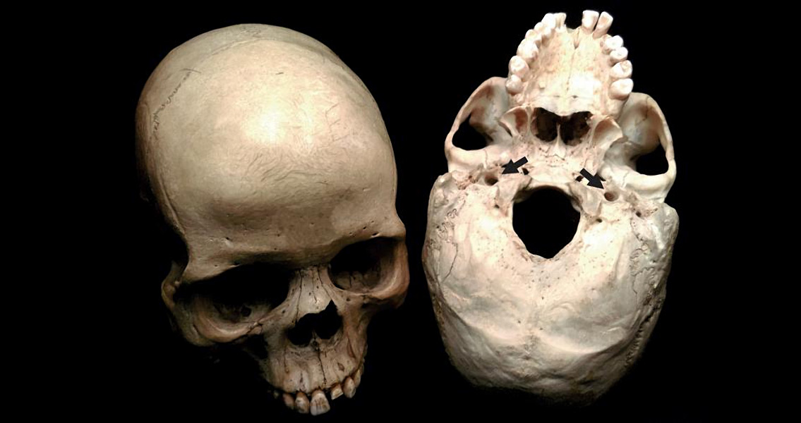 Human skulls (1)