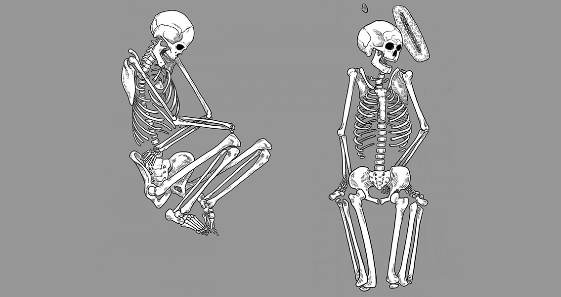 skeletal-remains-1