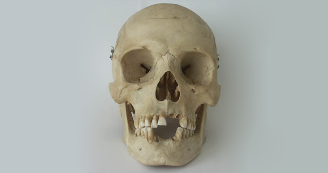 skull-from-the-front