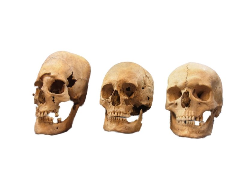 Elongated skulls reveal female-biased immigration to Early Medieval Germany